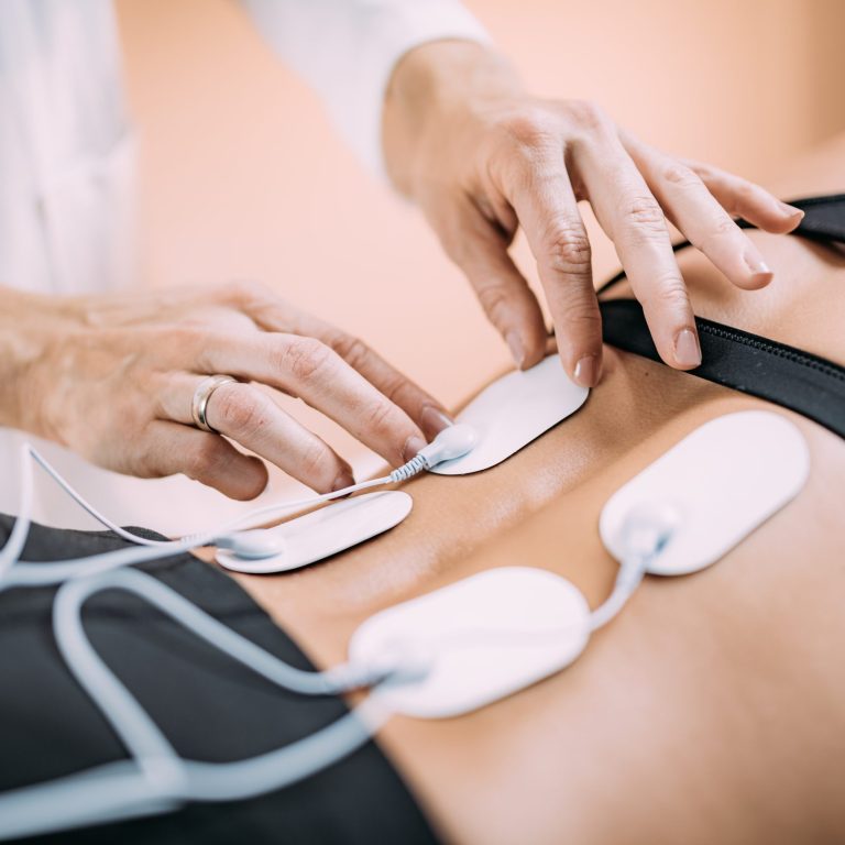 Lower Back Physical Therapy with TENS Electrode Pads, Transcutaneous Electrical Nerve Stimulation. Therapist Positioning Electrodes onto Patient's Lower Back